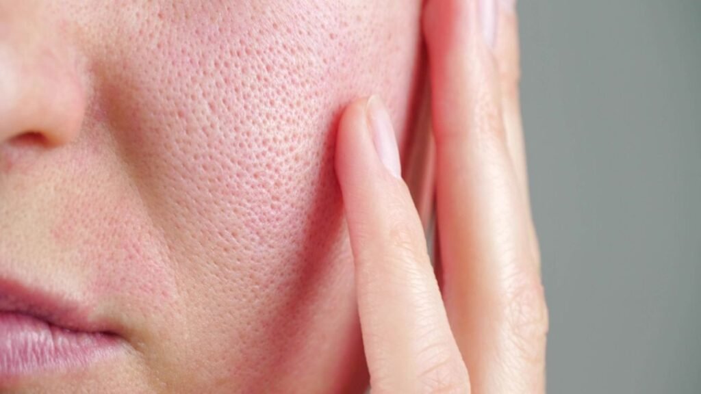 El frío invernal agrava problemas dermatológicos y genera alertas médicas