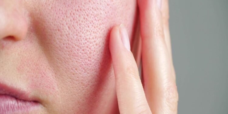 El frío invernal agrava problemas dermatológicos y genera alertas médicas