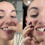 Influencer viral relata su “maldición dental” tras múltiples tratamientos