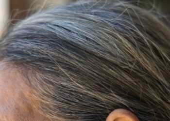 Causas detrás de las canas: ¿estrés y nutrición aceleran el proceso?
