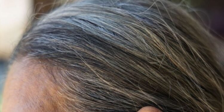 Causas detrás de las canas: ¿estrés y nutrición aceleran el proceso?