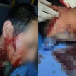 Colectivero de la línea 57 atacado tras discusión por el valor del boleto