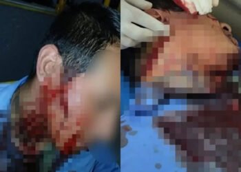 Colectivero de la línea 57 atacado tras discusión por el valor del boleto