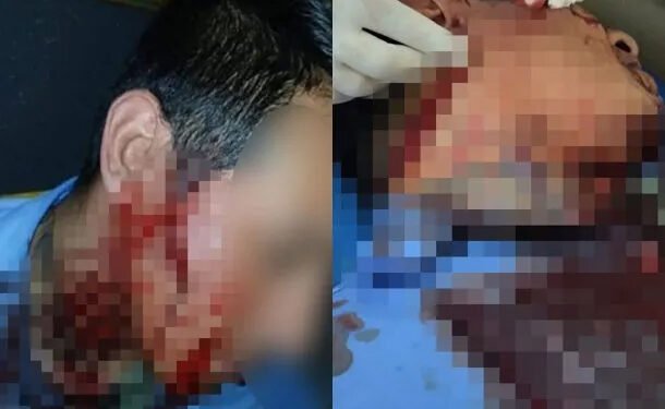 Colectivero de la línea 57 atacado tras discusión por el valor del boleto