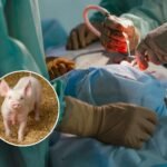 Investigadores logran trasplante de pulmón de cerdo a humano en muerte cerebral