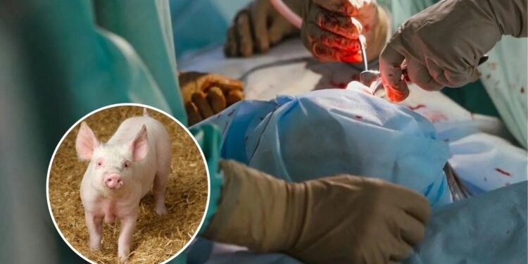 Investigadores logran trasplante de pulmón de cerdo a humano en muerte cerebral