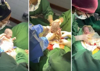 Nacen trigemelas monocoriales en Salta, un caso excepcional que asombra a la comunidad médica