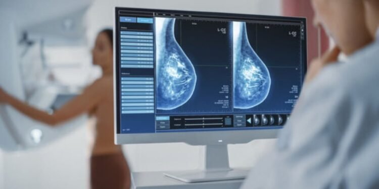 Cáncer de mama: Argentina diagnostica 360 casos diarios y prioriza mamografías a los 40 años
