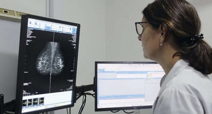 La Provincia de Buenos Aires adelantará mamografías a los 40 años