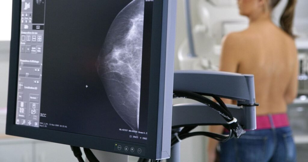 El Ministerio de Salud bonaerense adelanta mamografías a los 40 años