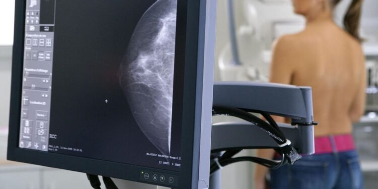 El Ministerio de Salud bonaerense adelanta mamografías a los 40 años