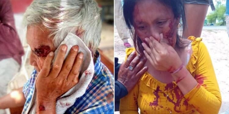 Fue violento el enfrentamiento en Villa Río Bermejito por ayudas sociales