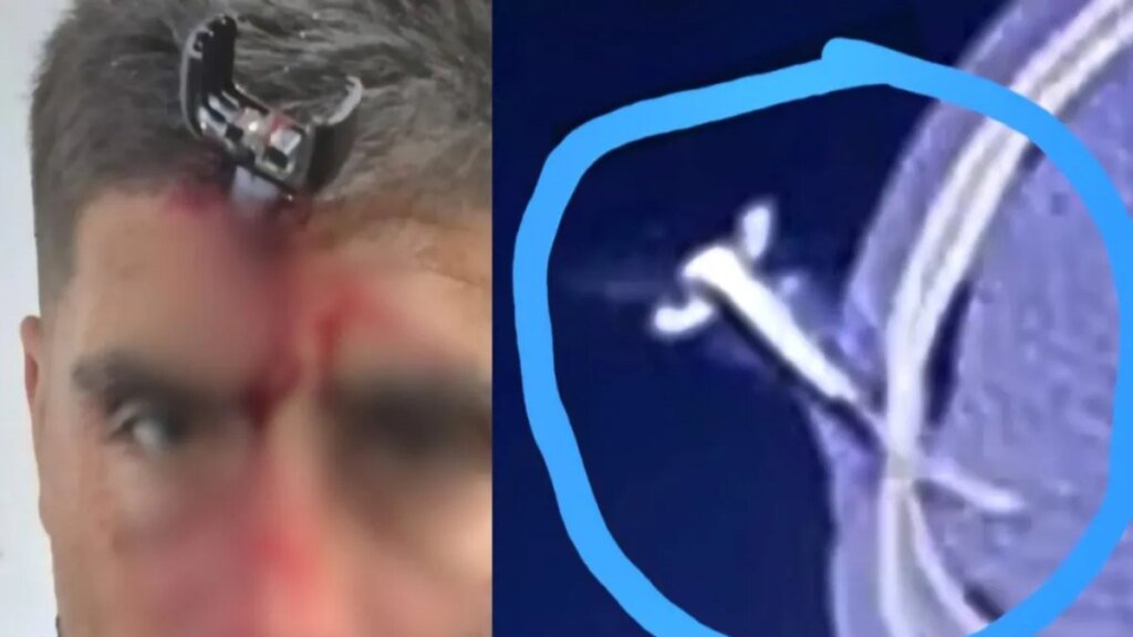 Grave ataque a futbolista: le clavan una llave en la cabeza en un torneo femenino en Berazategui