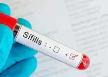 Aumentan los casos de sífilis en Argentina: un 20% más en 2025 y récord histórico a la vista