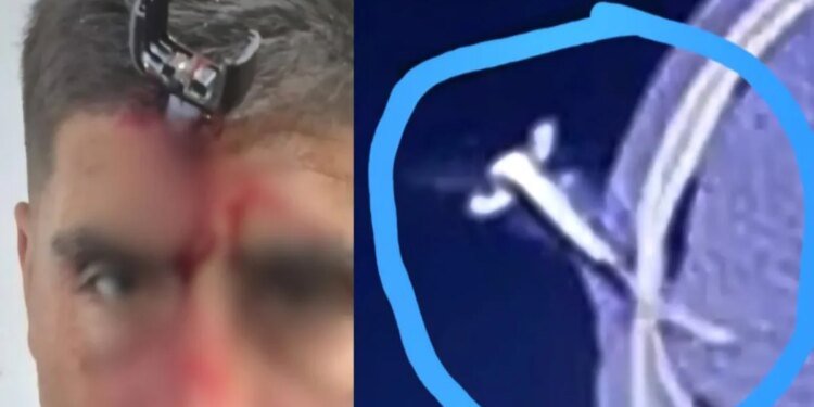 Grave ataque a Jonathan Smith: le clavaron una llave en la cabeza en un partido infantil en Berazategui