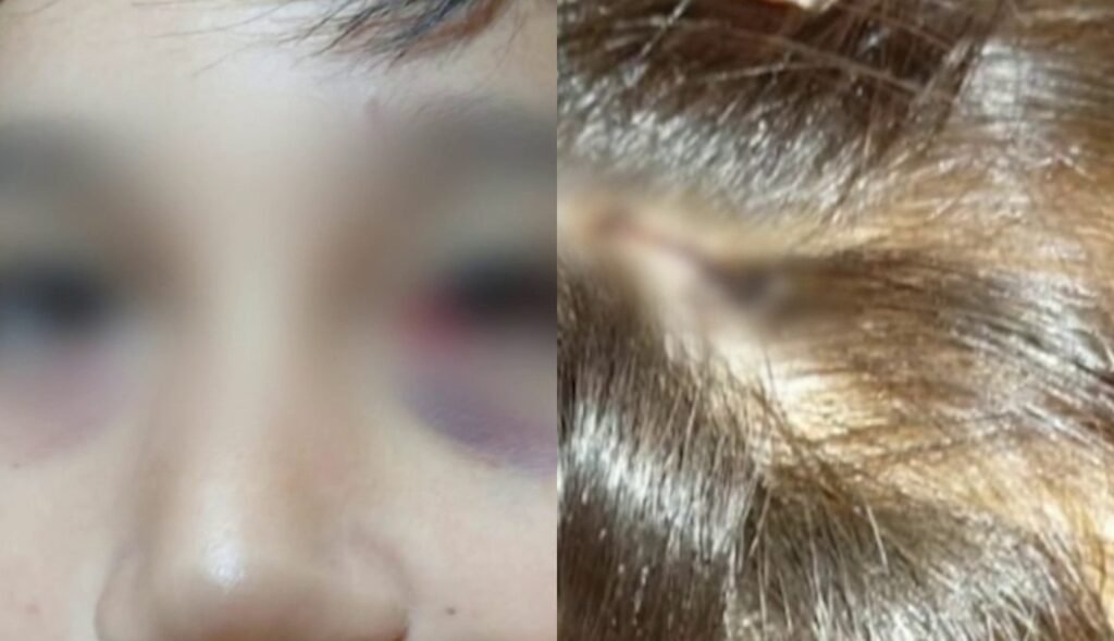 Mar del Plata: nene de 13 años fue apuñalado con una lapicera por un compañero de clase