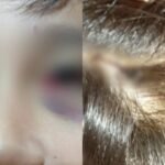 Mar del Plata: nene de 13 años fue apuñalado con una lapicera por un compañero de clase