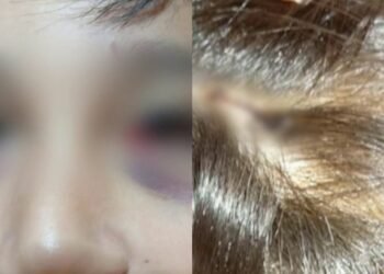 Mar del Plata: nene de 13 años fue apuñalado con una lapicera por un compañero de clase