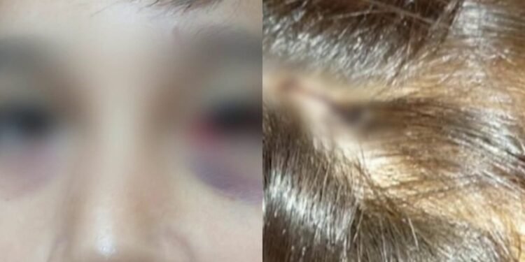 Mar del Plata: nene de 13 años fue apuñalado con una lapicera por un compañero de clase