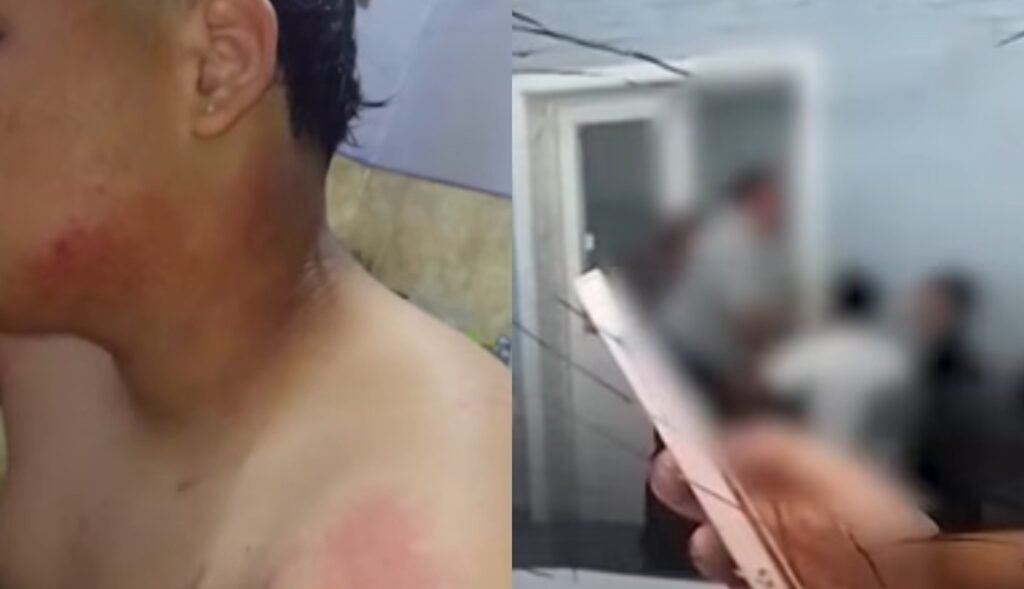 Chica hirió a compañero en plena clase al arrojarle un termo con agua caliente