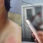 Chica hirió a compañero en plena clase al arrojarle un termo con agua caliente