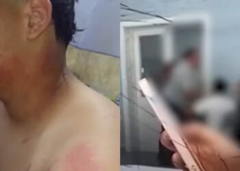 Chica hirió a compañero en plena clase al arrojarle un termo con agua caliente