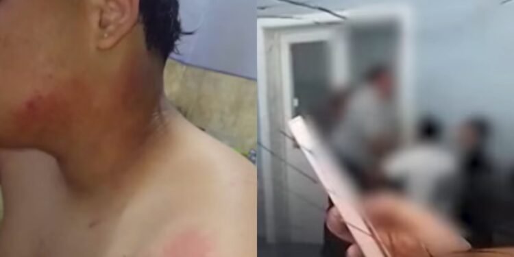 Chica hirió a compañero en plena clase al arrojarle un termo con agua caliente